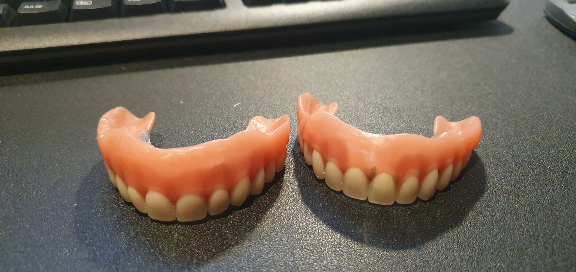 Når gebiss blir et problem: vanlige utfordringer med løse proteser – og veien til nye, faste tenner